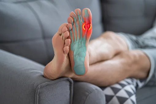 what is gout in the foot