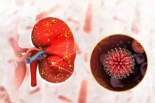 what is the first sign of kidney problems