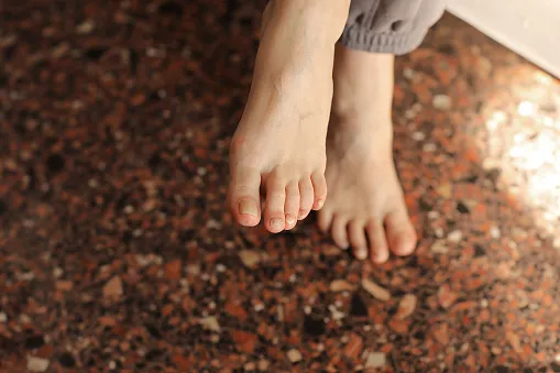 white toe nail fungus