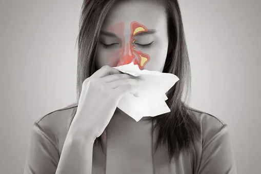 nasal polyps treatment