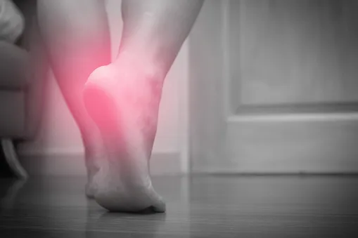 how to cure plantar fasciitis